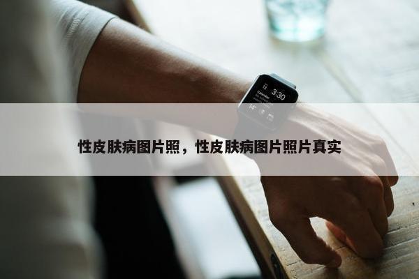 性皮肤病图片照，性皮肤病图片照片真实