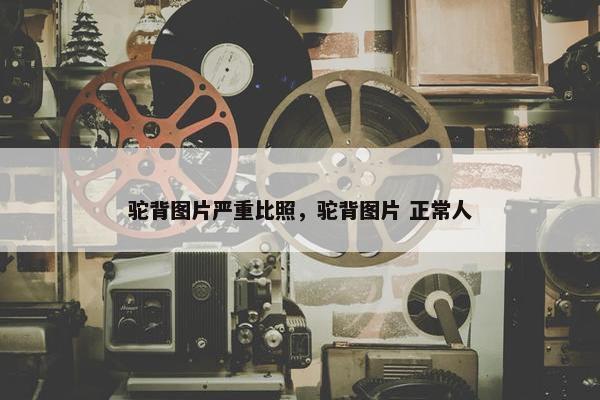 驼背图片严重比照，驼背图片 正常人